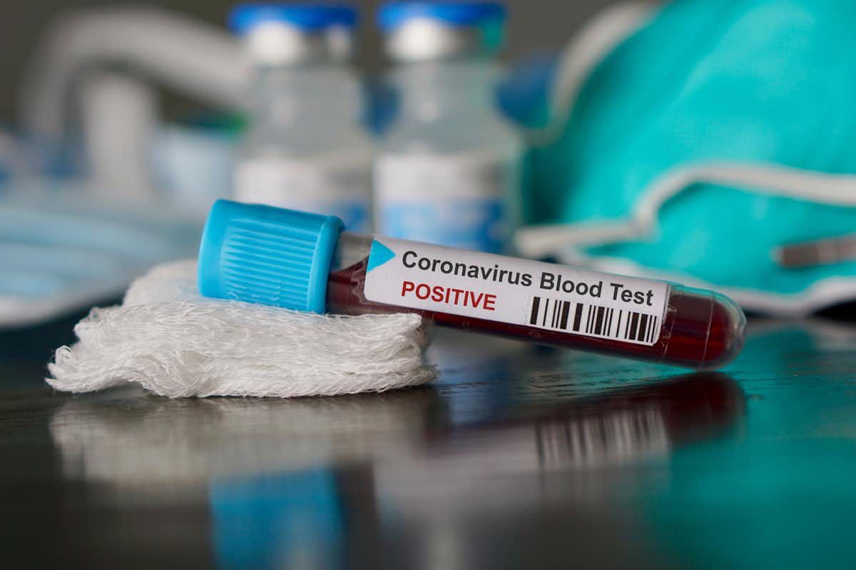 Coronavirus: las comparaciones entre países no tienen sentido a menos que tengamos en cuenta los sesgos en las pruebas