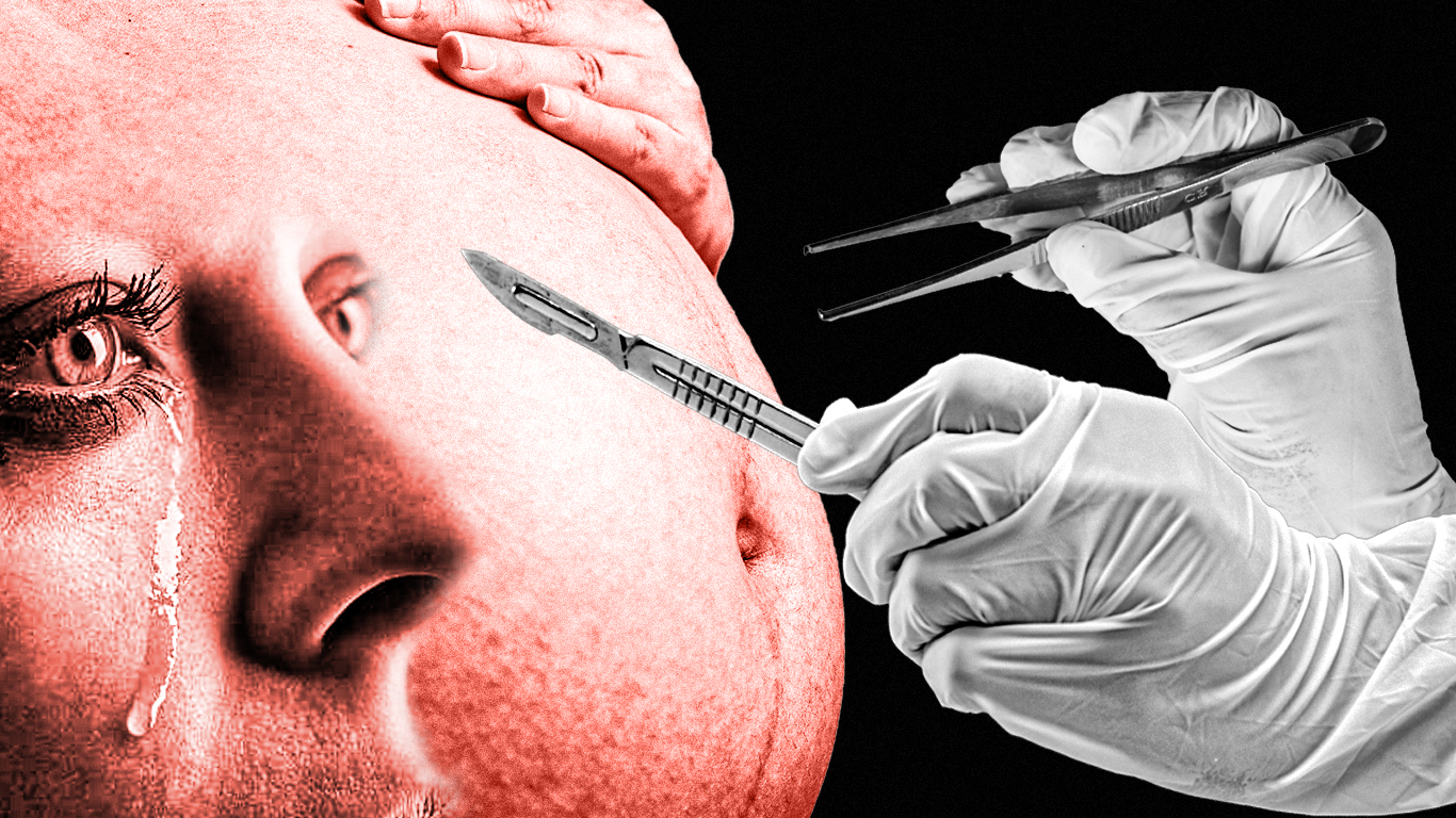 Temor en el quirófano: la violencia obstétrica persiste en salud pública